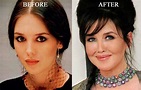 Isabelle Adjani Plastic Surgery Before And After Boto - vrogue.co