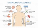 Common symptoms and signs of Leukemia. Medical illustration ideal for ...
