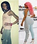 Did Nicki Minaj Have Plastic Surgery - Plastic Surgery Facts