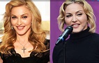 Madonna Plastic Surgery Before And After Face Photos | 2018 Plastic ...