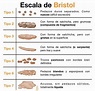 Escala De Bristol Para Imprimir