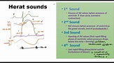 Heart Sounds - YouTube