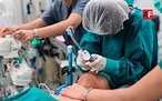 El 5% de los pacientes que son intubados por Covid-19, en riesgo de ...
