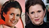 Carrie Fisher Facelift Plastic Surgery Before and After | Celebie