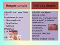 Herpes simple y sozter