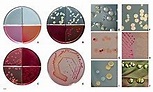 Escherichia coli - Wikipedia