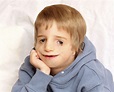 Treacher Collins Syndrome: What Is Treacher Collins Syndrome?