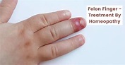 Felon Finger Infection - Causes & Treatment by Homeopathy