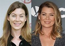 Ellen Pompeo Before and After Plastic Surgery: Face