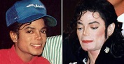 Why Michael Jackson's Skin Turned White Over The Years? - I'm A Useless ...