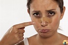 ¿Cómo desinflamar la nariz después de un golpe? ⁉️