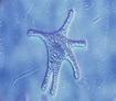 Protozoos: Amebas (superclase Sarcodina)