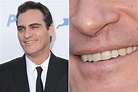 Chatter Busy: Joaquin Phoenix Cleft