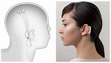 Elon Musk's Neuralink Brain Implant Will Let You Control Technology ...