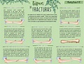 TIPOS DE FRACTURAS | Tipos de fracturas | Fracturas | uDocz