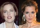 Gillian Anderson before and after plastic surgery (12) | Celebrity ...