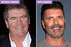 Simon Cowell's 'REAL' face without Botox and plastic surgery revealed ...