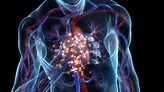 ¿Qué es el infarto agudo de miocardio? Síntomas, causas y cómo tratar