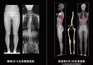 X光檢測技術再創新 新型「EOS」輻射量較傳統減少50%｜東森新聞
