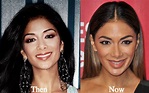 Nicole Scherzinger Plastic Surgery Before and After Photos - Latest ...