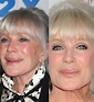 Linda Evans has done Plastic Surgery. She looks beautiful at this age ...