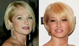 Ellen Barkin Facelift Plastic Surgery Before and After | Celebie