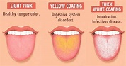 What Your Tongue Can Tell You About Your Health | Breckenridge Dental