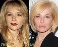 Ellen Barkin Plastic Surgery Facelift, Botox Injections Before and ...