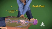 Cpr Cartoon - Cpr Resuscitation Animation Cardiopulmonary Medical 3d ...