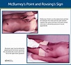 Appendicitis Nursing Care Management: Study Guide