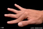 手指關節經常性疼痛要警惕：這不是痛風就是風濕！ - 每日頭條