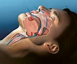 Obstruktives Schlaf-Apnoe-Syndrom – Universitätsspital Zürich