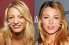 Did Blake Lively Have Plastic Surgery? (Before & After 2022)