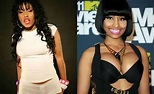 Nicki Minaj Breast Implants Plastic Surgery Before and After | Celebie