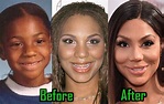 Tamar Braxton Plastic Surgery: Nose Job, Fillers, Before-After Photos ...