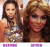 Did The Braxton Sisters Have Plastic Surgery Before And After
