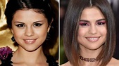 Selena Gomez's Before And After Looks: Calm Down Singer's Beauty ...