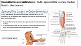 Epicondilitis Lateral Medial | Pablo Jesús Alva Cuadros | uDocz