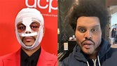 ¿Qué retoques se ha hecho The Weeknd en la cara? - Telecinco