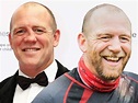 What Happened To Mike Tindall Nose? Surgery Before And After