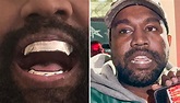 Kanye West seemingly replaces teeth with 'epic' $1.39m titanium ...
