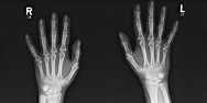 Röntgen und Spezialuntersuchungen – Gemeinschaftspraxis Radiologie