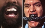 Kanye West installs $850,000 Jaws-inspired titanium teeth