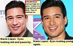 Mario Lopez Plastic Surgery? You be the judge. – The Damien Zone
