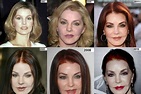 Priscilla Presley Plastic Surgery - Plastic Surgery Disasters