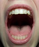 Mouth Detail Front by Della-Stock on deviantART | Beautiful teeth ...