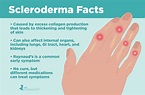 What is Scleroderma? Understanding Symptoms, Causes, and Treatments