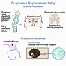 Clinical Pathology Glossary: Progressive Supranuclear Palsy | ditki ...