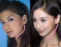 The miraculous transformation of the Angelababy plastic surgery