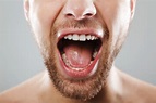 ¿Cuáles son las causas de la saliva espesa? - ViardenLab